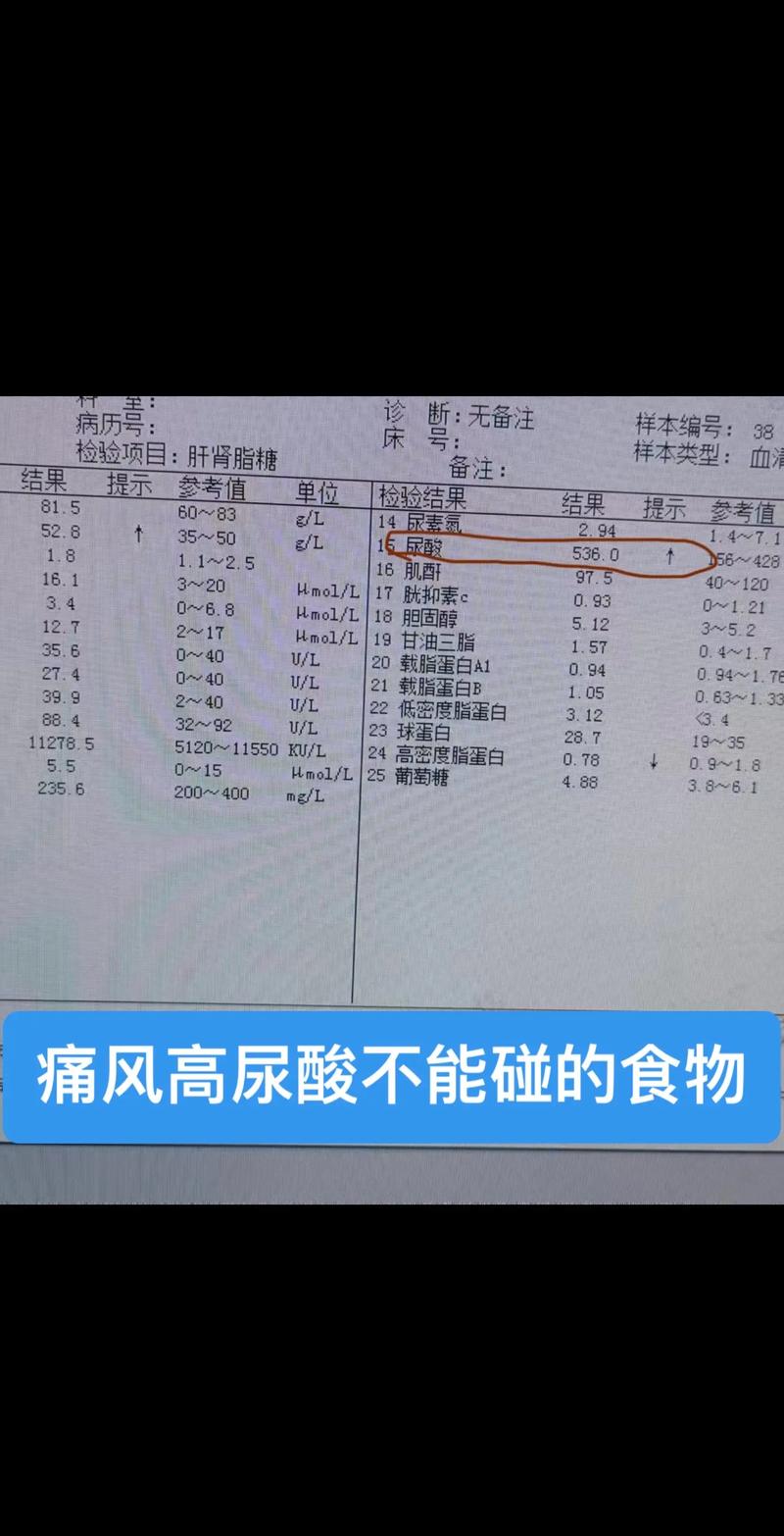什么是尿酸升高:什么是尿酸升高症状